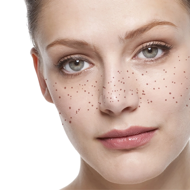 перевідні тату веснянки